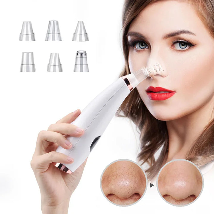 Electric Blackhead Remover Vacuum Acne