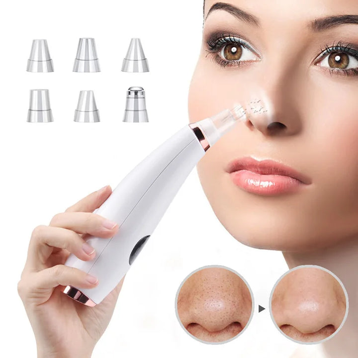 Electric Blackhead Remover Vacuum Acne